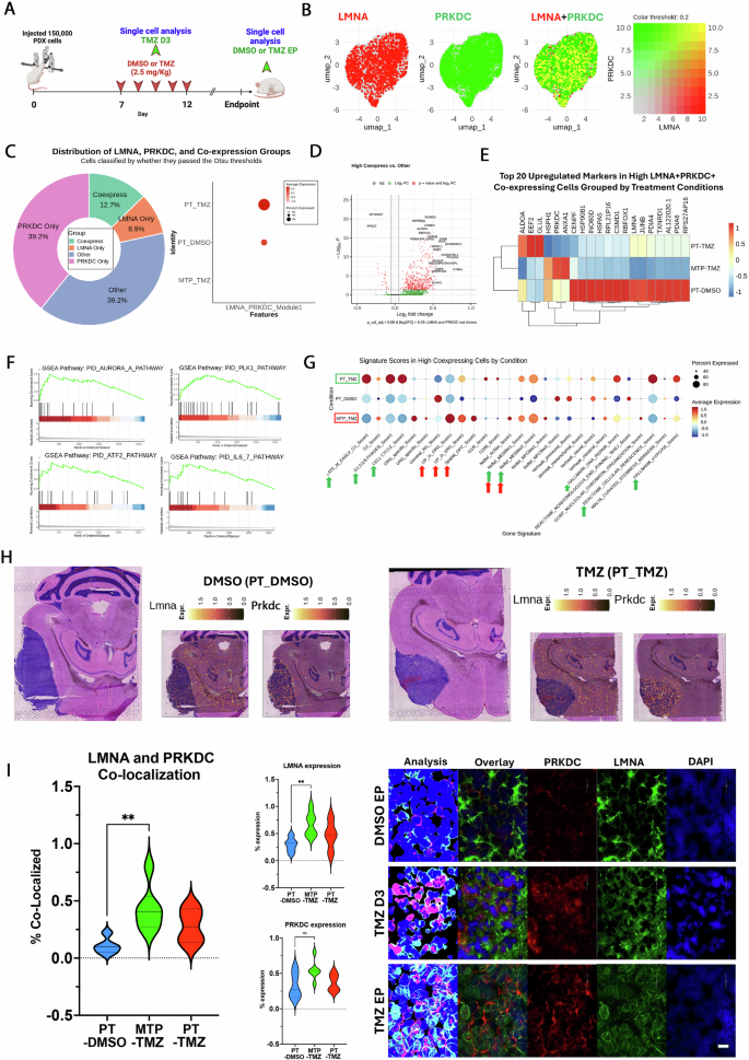 Fig. 5: Co-expression of LMNA and PRKDC defines a distinct GBM subpopulation with unique transcriptional and epigenetic characteristics.
