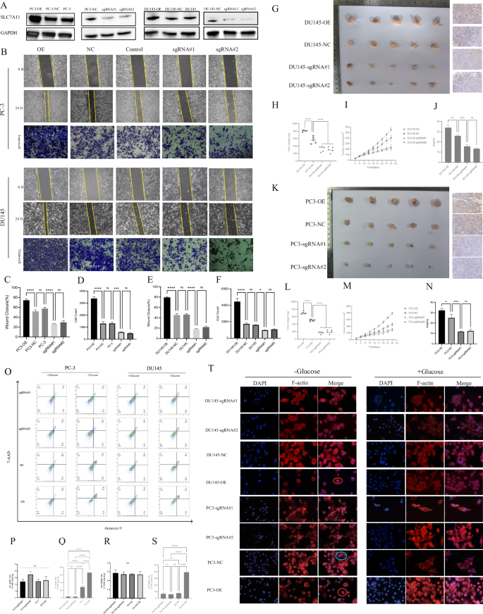Fig. 2: Effects of SLC7A11 on prostate cancer cell viability.