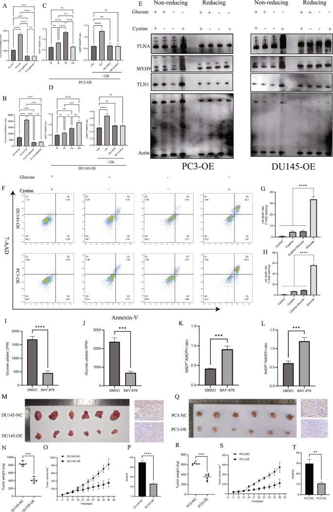 Fig. 6: Effects of SLC7A11 on cellular metabolism.