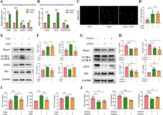 Fig. 3: Effects of Piezo1 and autophagy on monocyte-derived macrophages in vitro.