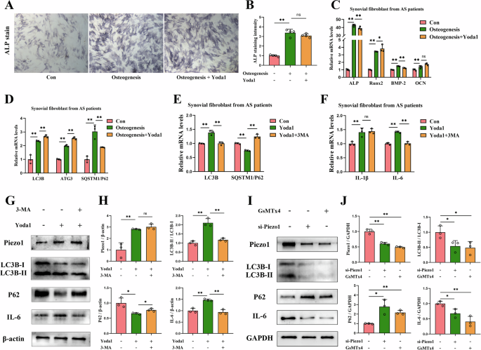 Fig. 4: Effects of Piezo1 and autophagy on FLS in vitro.