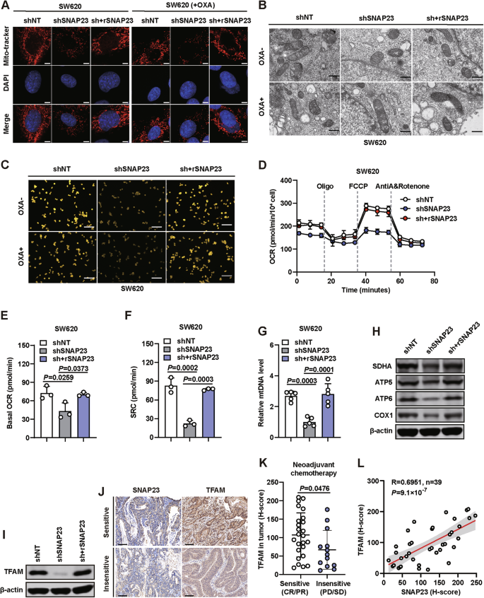Fig. 4: SNAP23 depletion cells retains better mitochondrial function and integrity with less mitochondrial content and respiratory capacity.