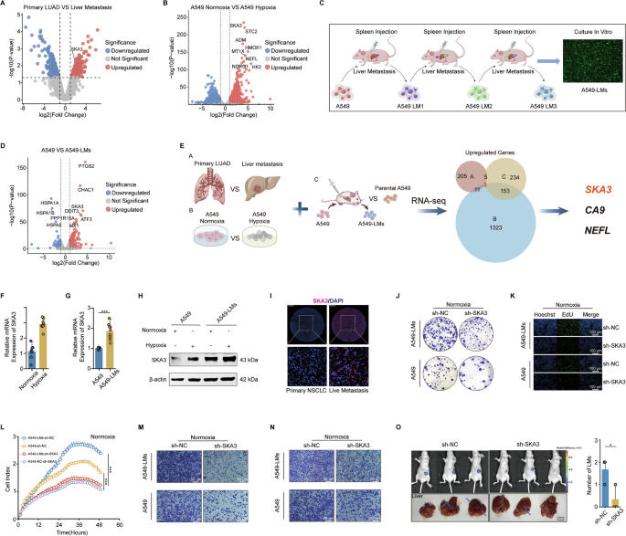 Fig. 1: SKA3 overcame the hepatic hypoxia barrier to promote liver metastasis in LUAD.