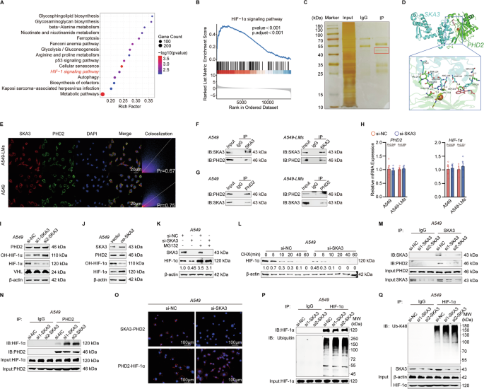 Fig. 3: SKA3 enhanced the glycolysis of LUAD cells by stabilizing the HIF-1α protein.