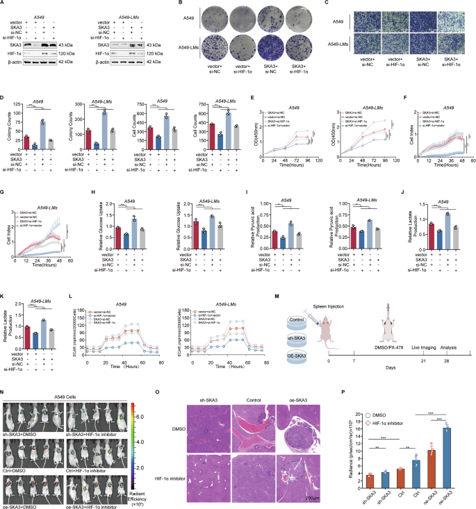 Fig. 4: SKA3-mediated HIF-1α stabilization promoted liver metastasis in LUAD.