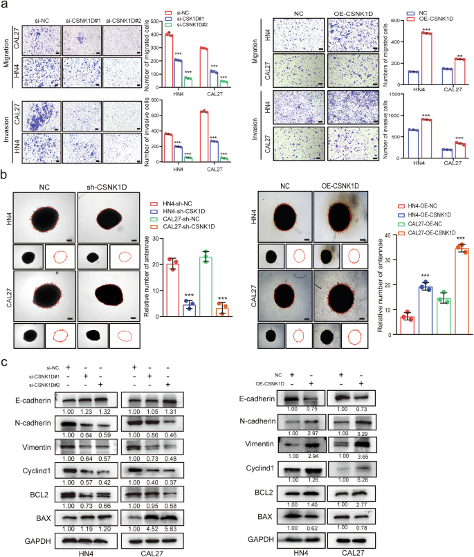 Fig. 3: Effects of the elevated CSNK1D on the tumor malignant potential of HNSCC cells in vitro.