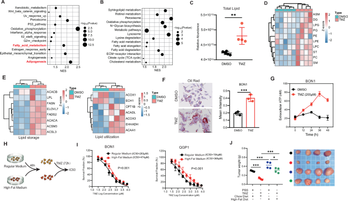 Fig. 1: High lipid metabolism confer resistance to TMZ in pNETs.