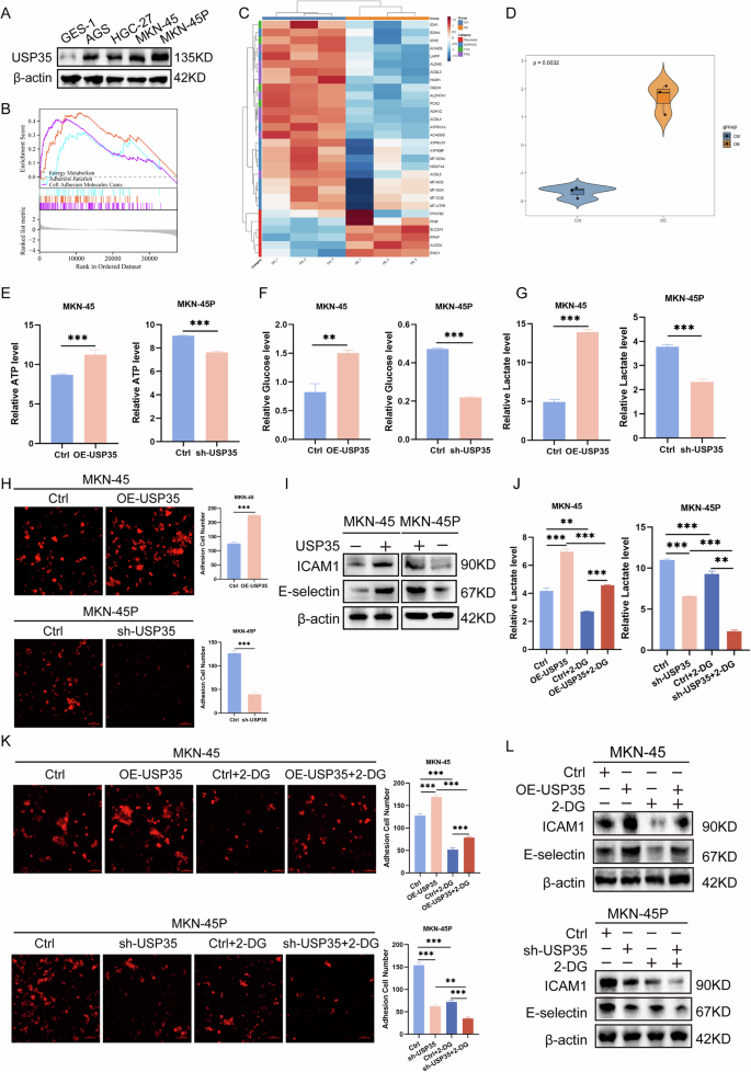 Fig. 2: USP35 enhances the colonization ability of GC cells by regulating energy metabolism reprogramming.