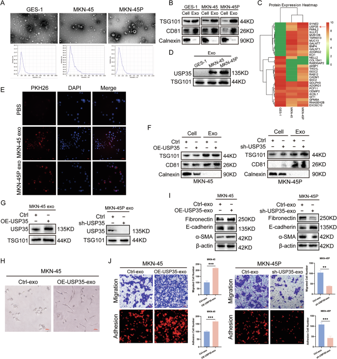 Fig. 5: Exosome USP35 enhances the colonization ability of GC cells by promoting MMT in PMCs.