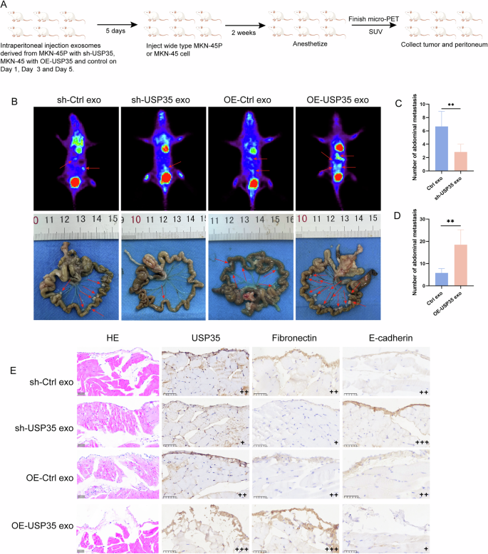 Fig. 7: Exosome USP35 derived from GC cells promotes GCPD by inducing MMT of PMCs in vivo.