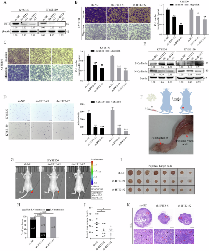 Fig. 2: Silencing IFIT3 suppresses ESCC cell metastasis in vitro and LNM in ESCC-bearing nude mice.