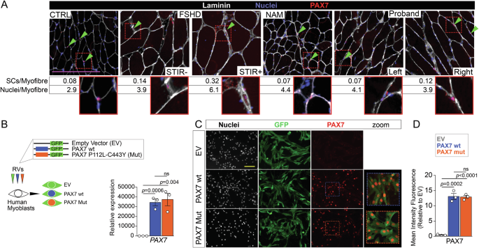 Fig. 3: P112L-C443Y variants do not alter PAX7 stability.
