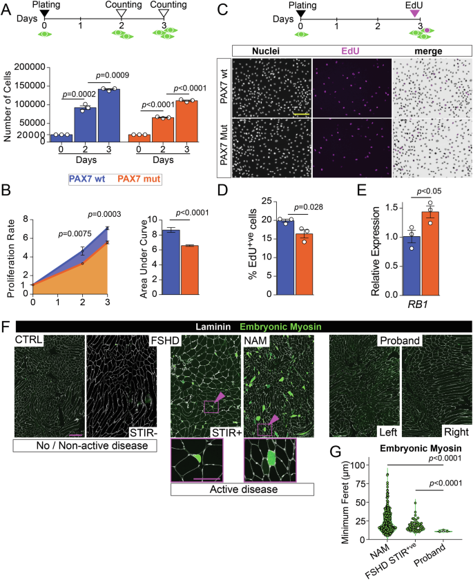 Fig. 6: PAX7 P112L-C443Y decreases myoblast proliferation and likely contributes to reduced muscle regenerative potential in the proband.
