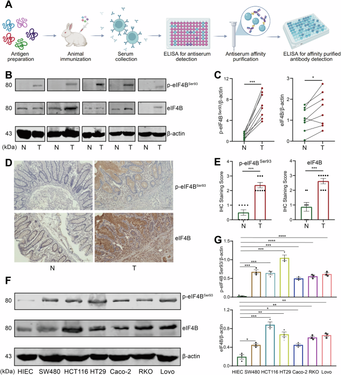 Fig. 2: The levels of eIF4B and its Ser93 phosphorylation increase in CRC tissues and cell lines.