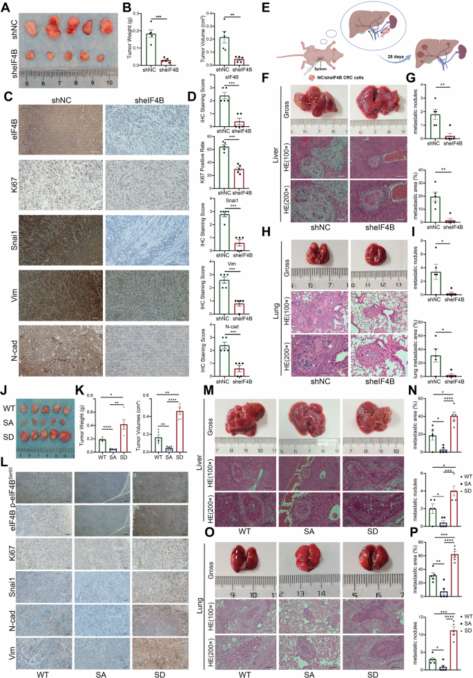 Fig. 5: eIF4B knockdown inhibited CRC growth and metastasis, while Ser93 phosphorylation promoted these processes in vivo.