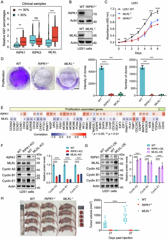 Fig. 2: Depletion of RIPK1 or MLKL inhibits glioma proliferation in vitro and in vivo.