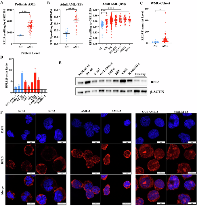 Fig. 1: RPL5 is highly expressed in AML.