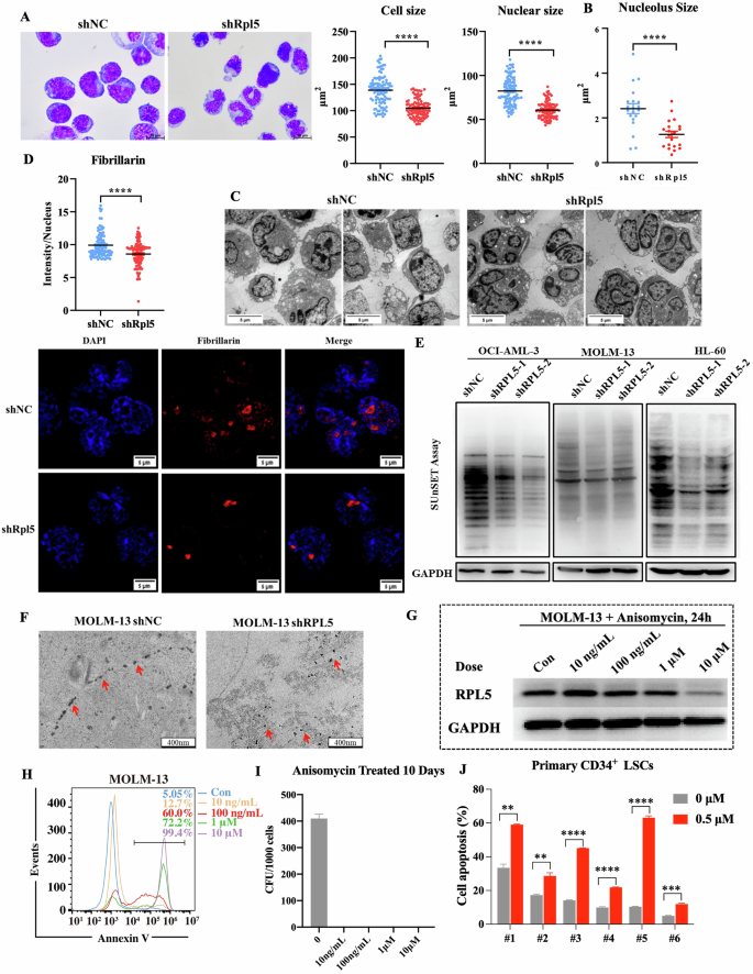 Fig. 5: RPL5 deficiency induces ribosomal stress.
