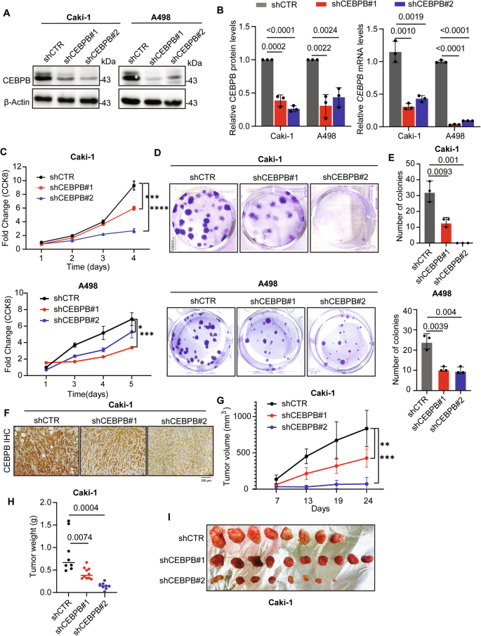 Fig. 2: CEBPB promotes ccRCC in vitro and in vivo.