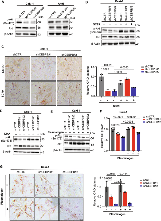 Fig. 5: CEBPB-GPD1L axis-mediated ether lipid synthesis regulates Akt activity.