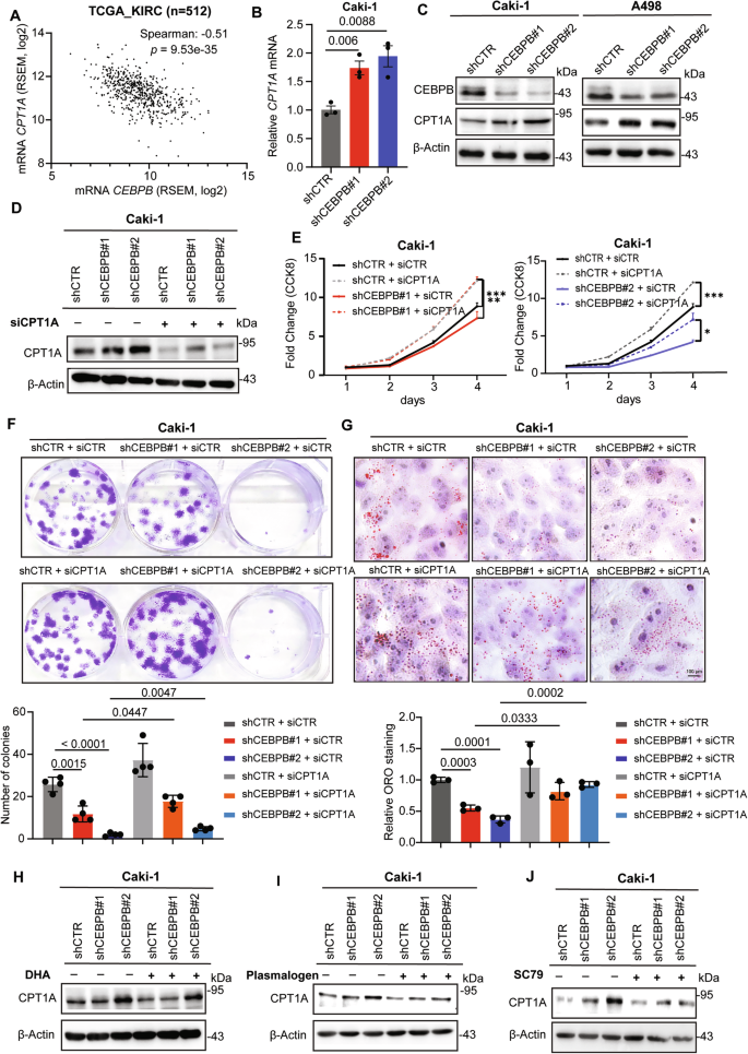 Fig. 6: CEBPB inhibits CPT1A expression via Akt activity.