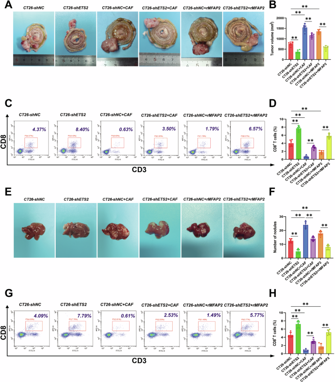 Fig. 7: MFAP2 promotes CRC progression through ETS2 in vivo.