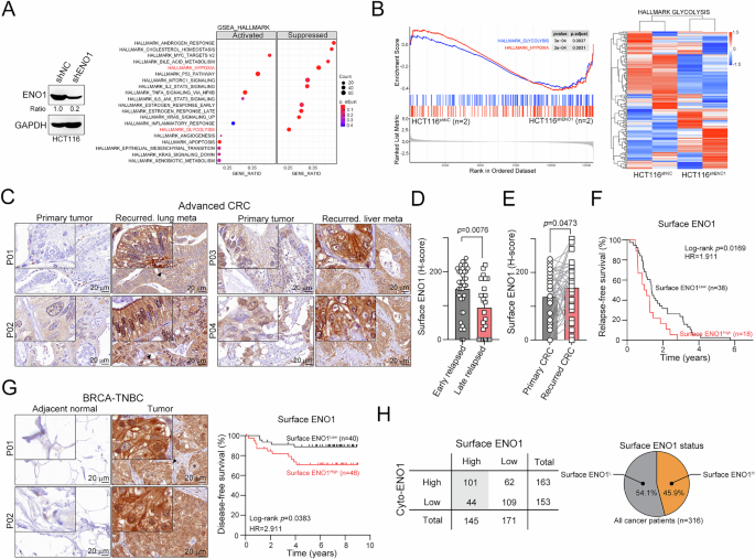 Fig. 1: High surface expression of ENO1 was associated with poor survival outcomes in advanced CRC patients and TNBC patients.