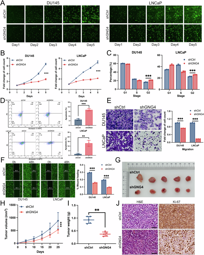 Fig. 2: GNG4 is essential for the growth and tumor progression of prostate cancer.