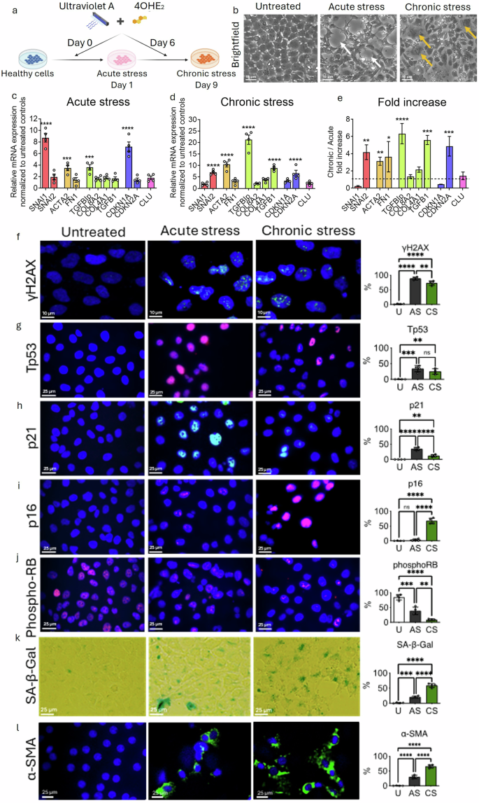 Fig. 2: Chronic UVA + 4OHE2 exposure induces mature senescence via the p16-pRB pathway and promotes fibrosis in HCEnC-21T cells.