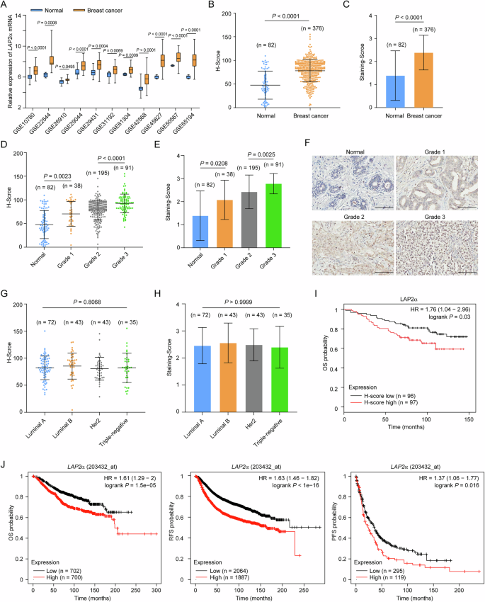 Fig. 1: LAP2α is implicated in breast tumorigenesis.
