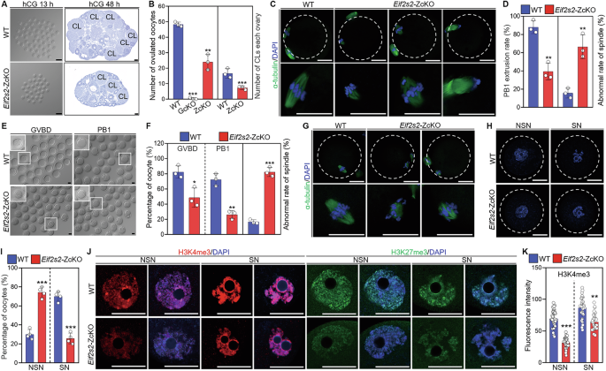 Fig. 2: Depletion of Eif2s2 in oocytes impairs oocyte maturation.