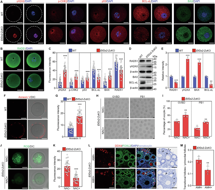 Fig. 8: Depletion of Eif2s2 in oocytes induces DNA damage and oocyte apoptosis.