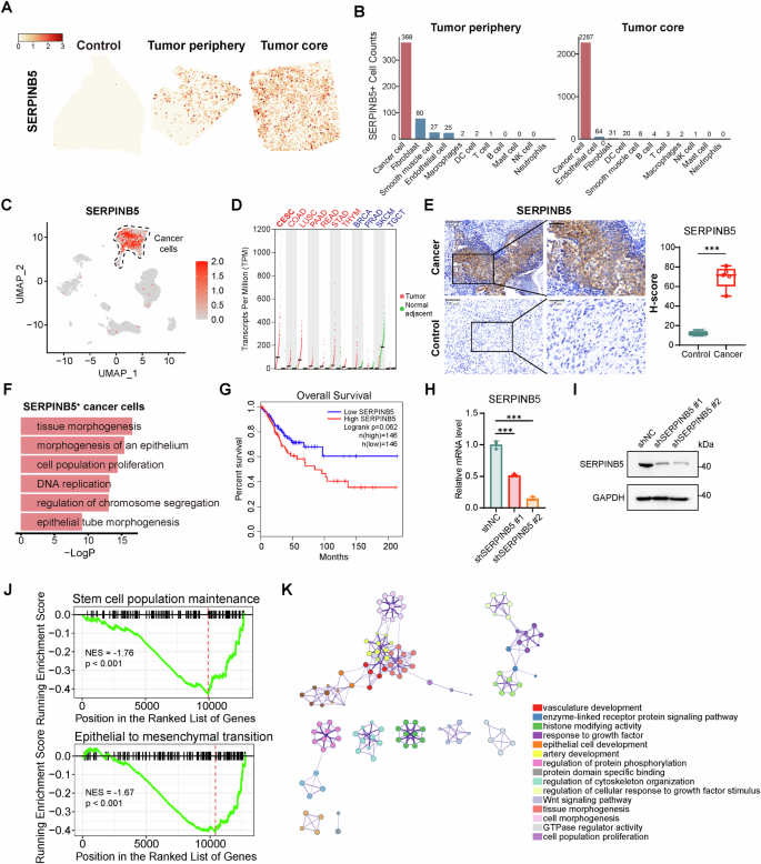 Fig. 5: Multi-level analyses identify SERPINB5+ cancer cells as a malignant subpopulation in cervical cancer.