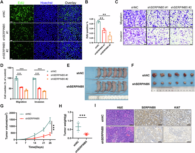 Fig. 6: SERPINB5 promotes cervical cancer cell proliferation, metastasis, and tumor growth in vitro and in vivo.