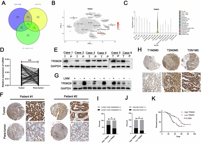Fig. 1: TRIM29 is aberrantly increased in GC and is an excellent prognostic biomarker for GC.