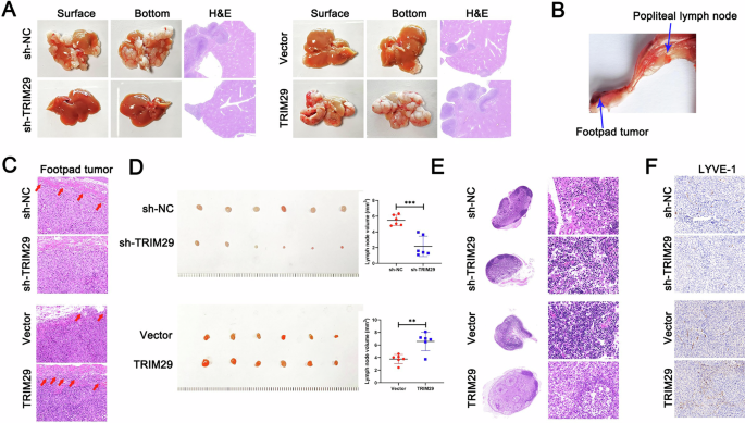 Fig. 3: TRIM29 induces metastasis and lymphangiogenesis in GC in vivo.