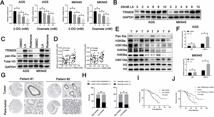 Fig. 6: H3K9 lactylation was responsible for the increased expression of TRIM29.