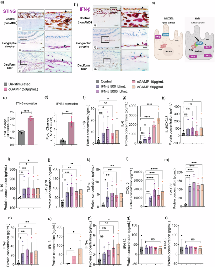 Fig. 1: STING and IFN-β proteins are expressed in the RPE of human retinal tissues and upregulated in response to cGAMP stimulation.