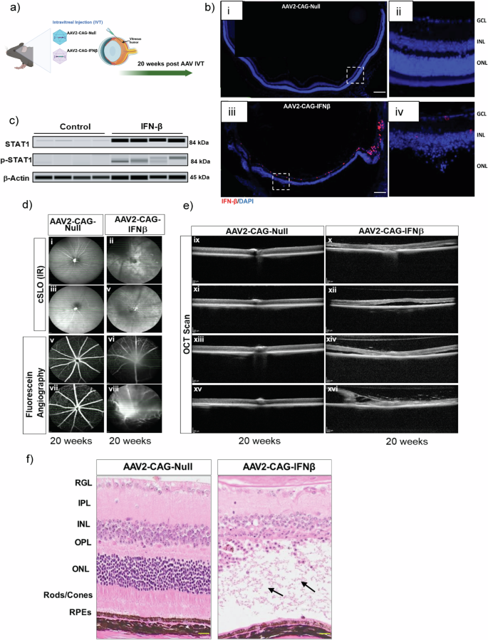 Fig. 6: Chronic IFN-β induction (20 weeks) leads to profound retinal degeneration in vivo.