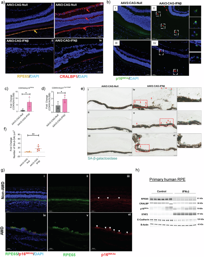 Fig. 7: Chronic IFN-β exposure diminishes RPE-specific markers and induces cellular senescence.