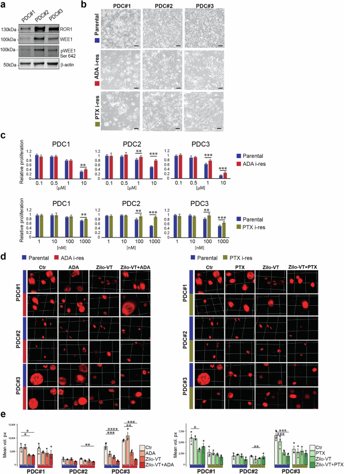 Fig. 7: Targeting ROR1 in drug-naïve and ADA- or PTX i-res primary HGSOC tumor-derived cells (PDCs).