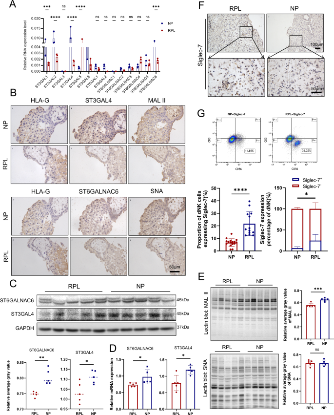 Fig. 2: Validation of single‒cell transcriptomic findings in clinical samples.