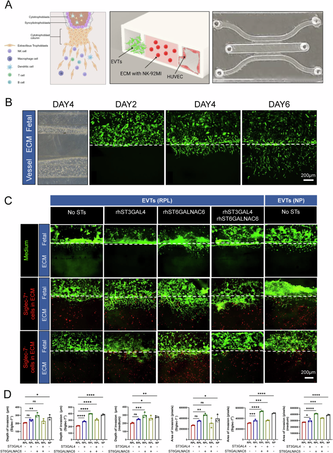 Fig. 8: ST6GALNAC6 rescues impaired invasiveness of RPL-derived EVT cells in a microfluidic implantation-on-chip model.