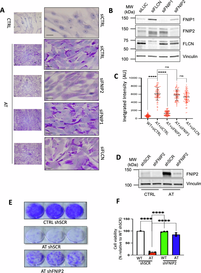 Fig. 4: FNIP2 silencing restores glycogen homeostasis and fitness in AT cells.