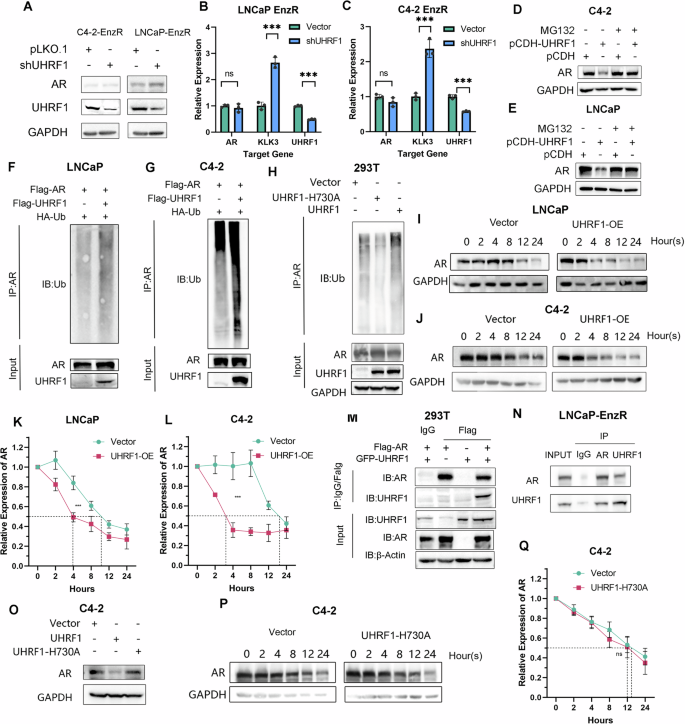 Fig. 3: UHRF1 promotes AR ubiquitination and consequently AR degradation.