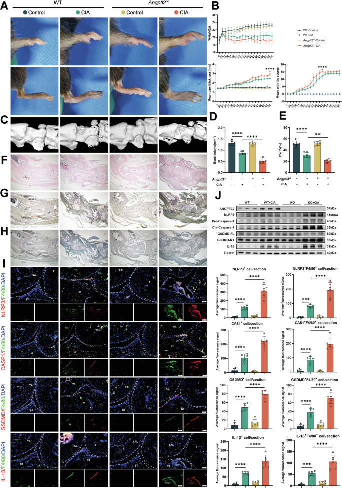 Fig. 1: ANGPTL2 deficiency exacerbates pyroptosis and joint damage in a mouse model of rheumatoid arthritis.