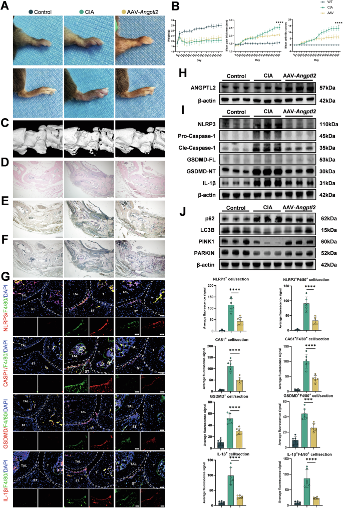 Fig. 8: Intra-articular delivery of ANGPTL2 alleviates rheumatoid arthritis by restoring mitophagy and suppressing pyroptosis.