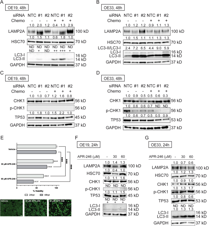 Fig. 4: TTLL12-201 knockdown induces chaperone-mediated autophagy (CMA) in OE19 and OE33 cells.