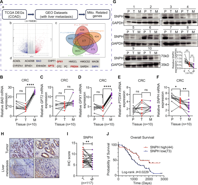 Fig. 1: SNPH is progressively down-regulated in colorectal cancer and liver metastases and significantly contributes to poor patient prognosis.