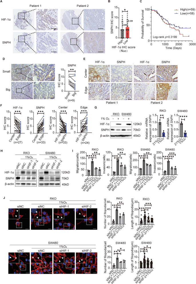 Fig. 3: Hypoxia-mediated SNPH down-regulation in CRC.